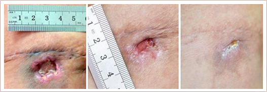 linline in surgery